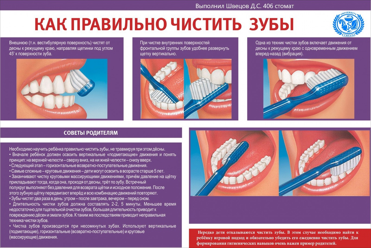 Средства ухода за зубами проект