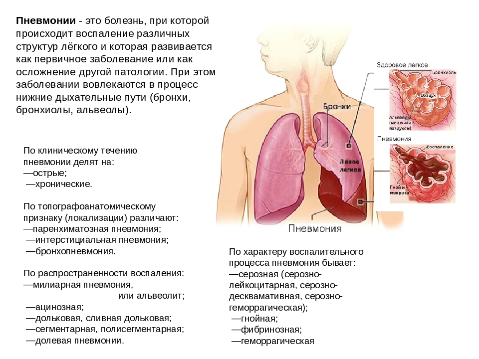 Сколько дней человек заразен при орви